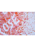 Isabelle Pelletane, La vie en rose, peinture - Galerie de vente et d’achat d’art contemporain en ligne Artalistic